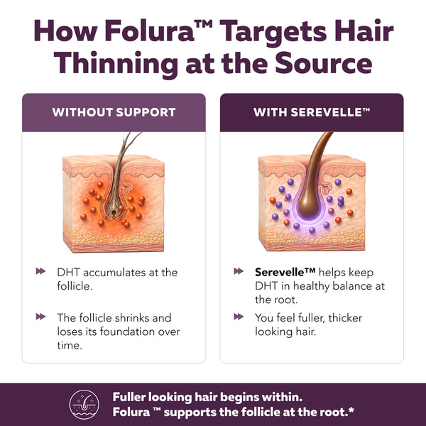 Folura diagram comparing hair follicles without support versus with Serevelle saw palmetto