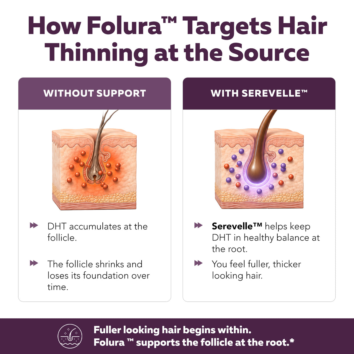 Folura diagram comparing hair follicles without support versus with Serevelle saw palmetto