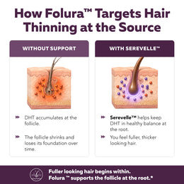 Folura diagram comparing hair follicles without support versus with Serevelle saw palmetto