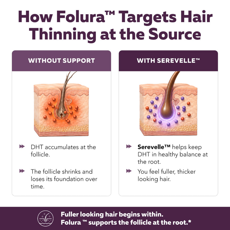 Folura diagram comparing hair follicles without support versus with Serevelle saw palmetto
