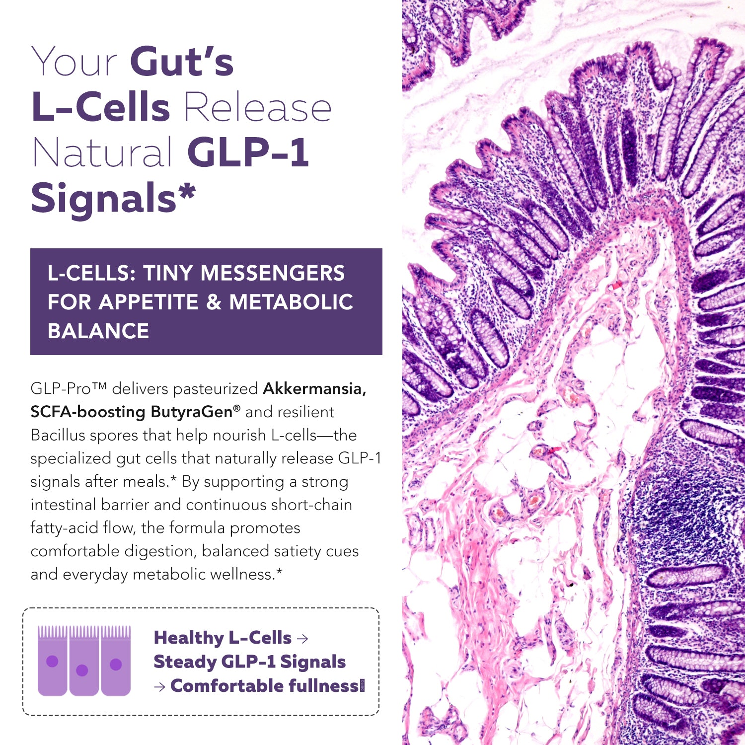 GLP-Pro probiotic and postbiotic formula supporting intestinal L-cells that release natural GLP-1 signals using Akkermansia muciniphila, ButyraGen butyrate and Bacillus spore probiotics